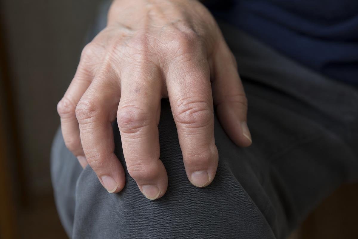 Close-up of an older person's hand resting on their knee